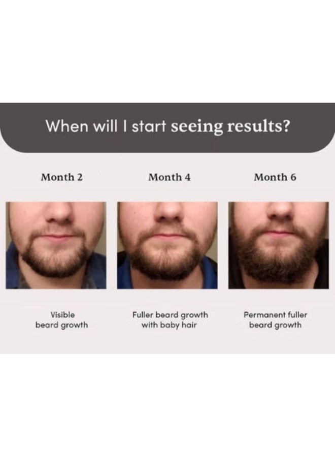 مان ماترز سيروم بيردماكس لنمو اللحية من مان ماترز، 30 مل | يحتوي على 5% مينوكسيديل | ينشط بصيلات شعر اللحية | يعالج مشكلة نمو اللحية غير المتساوي والمتفرق. - Image 4